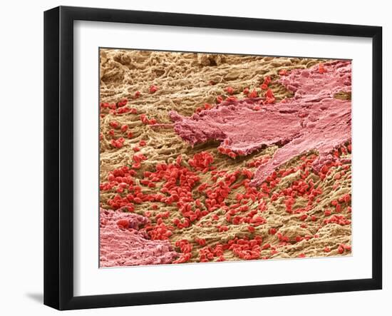 Uterus Lining During Menstruation, SEM-Steve Gschmeissner-Framed Photographic Print
