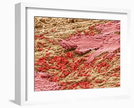 Uterus Lining During Menstruation, SEM-Steve Gschmeissner-Framed Photographic Print