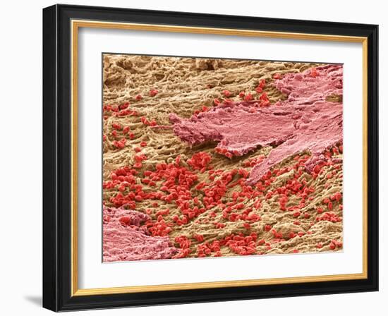 Uterus Lining During Menstruation, SEM-Steve Gschmeissner-Framed Photographic Print