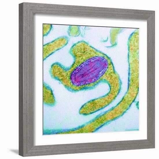 Vaccinia Virus Particle, TEM-Science Photo Library-Framed Premium Photographic Print