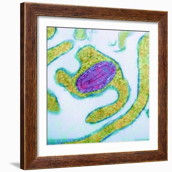 Vaccinia Virus Particle, TEM-Science Photo Library-Framed Premium Photographic Print