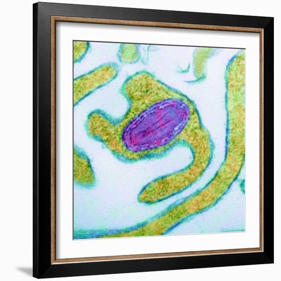 Vaccinia Virus Particle, TEM-Science Photo Library-Framed Premium Photographic Print
