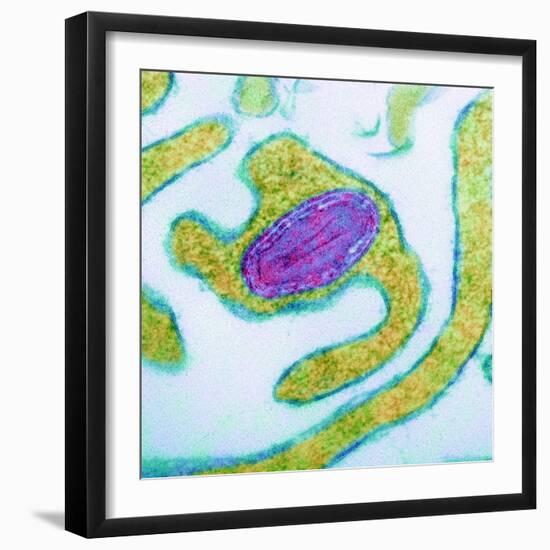 Vaccinia Virus Particle, TEM-Science Photo Library-Framed Premium Photographic Print