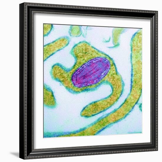 Vaccinia Virus Particle, TEM-Science Photo Library-Framed Premium Photographic Print