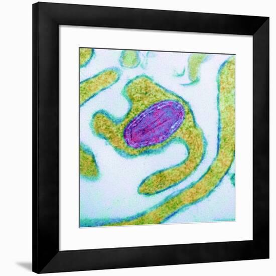 Vaccinia Virus Particle, TEM-Science Photo Library-Framed Photographic Print
