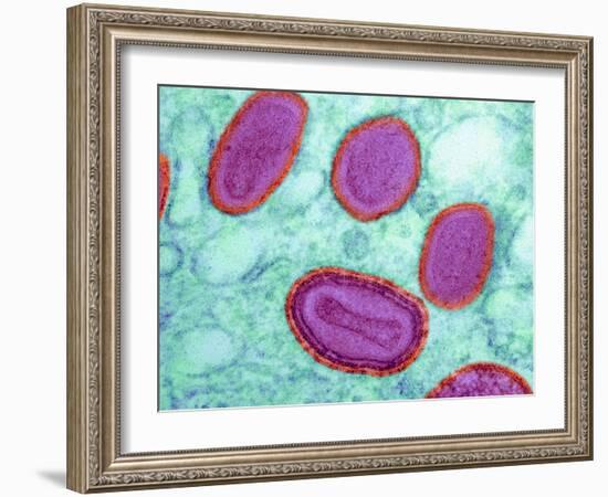 Vaccinia Virus Particles, TEM-Science Photo Library-Framed Photographic Print