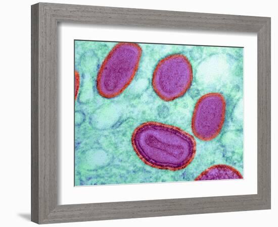 Vaccinia Virus Particles, TEM-Science Photo Library-Framed Photographic Print