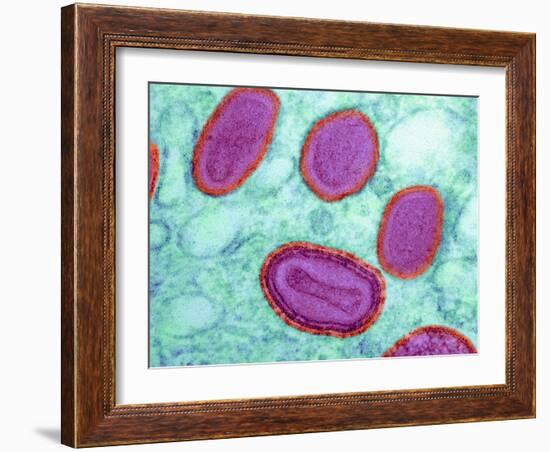 Vaccinia Virus Particles, TEM-Science Photo Library-Framed Photographic Print