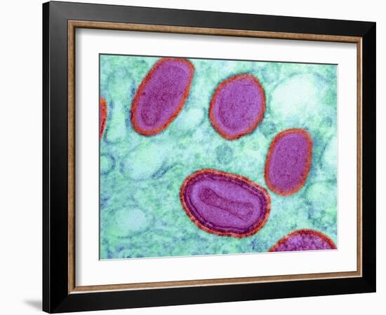 Vaccinia Virus Particles, TEM-Science Photo Library-Framed Photographic Print