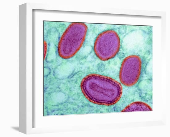 Vaccinia Virus Particles, TEM-Science Photo Library-Framed Photographic Print