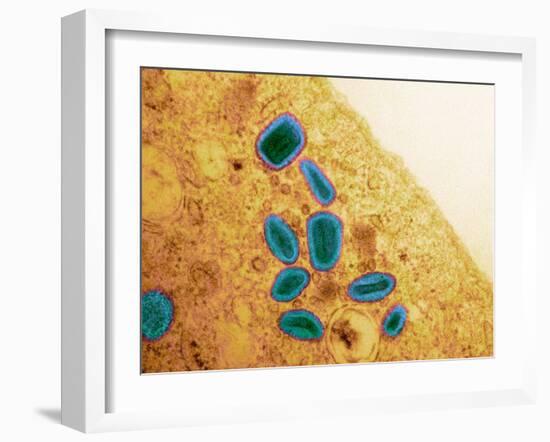 Vaccinia Virus Particles, TEM-Science Photo Library-Framed Photographic Print