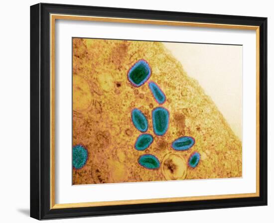 Vaccinia Virus Particles, TEM-Science Photo Library-Framed Photographic Print