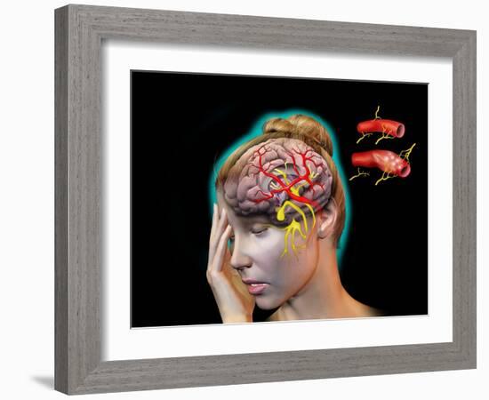 Vascular Causes of Headaches-Jose Antonio-Framed Photographic Print