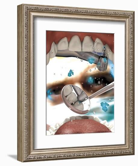 View Looking from Inside the Mouth While at the Dentist-null-Framed Art Print