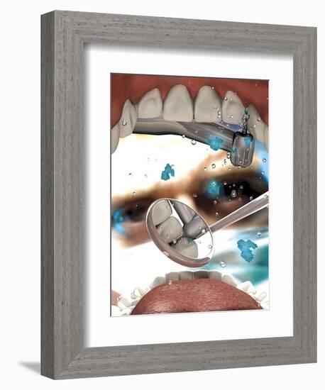 View Looking from Inside the Mouth While at the Dentist-null-Framed Art Print