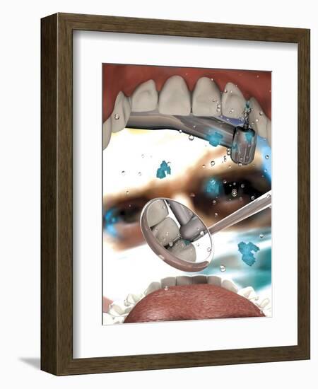 View Looking from Inside the Mouth While at the Dentist-null-Framed Art Print