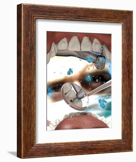 View Looking from Inside the Mouth While at the Dentist-null-Framed Art Print