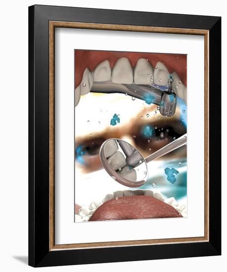 View Looking from Inside the Mouth While at the Dentist-null-Framed Art Print