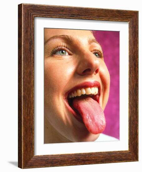 View of the Healthy Tongue of a Woman-Tek Image-Framed Photographic Print