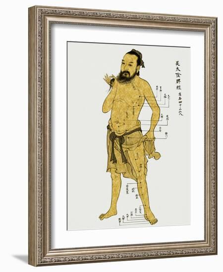 Vintage Acupunture-Oliver Jeffries-Framed Art Print