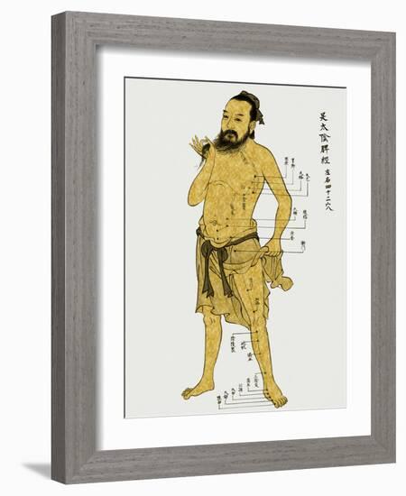 Vintage Acupunture-Oliver Jeffries-Framed Art Print