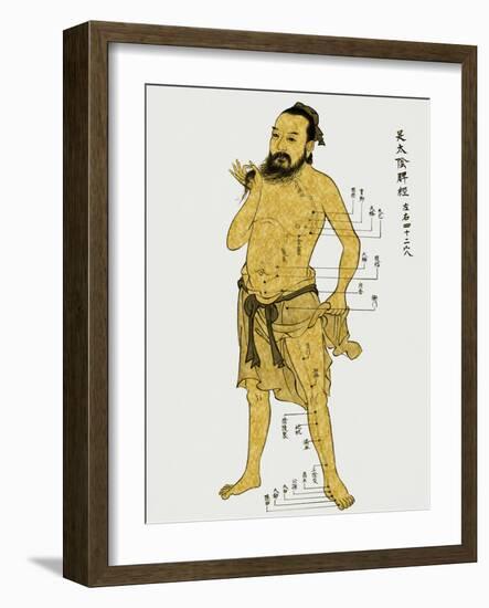 Vintage Acupunture-Oliver Jeffries-Framed Art Print