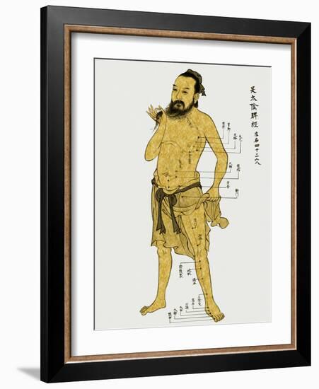 Vintage Acupunture-Oliver Jeffries-Framed Art Print