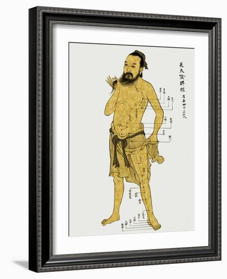 Vintage Acupunture-Oliver Jeffries-Framed Art Print