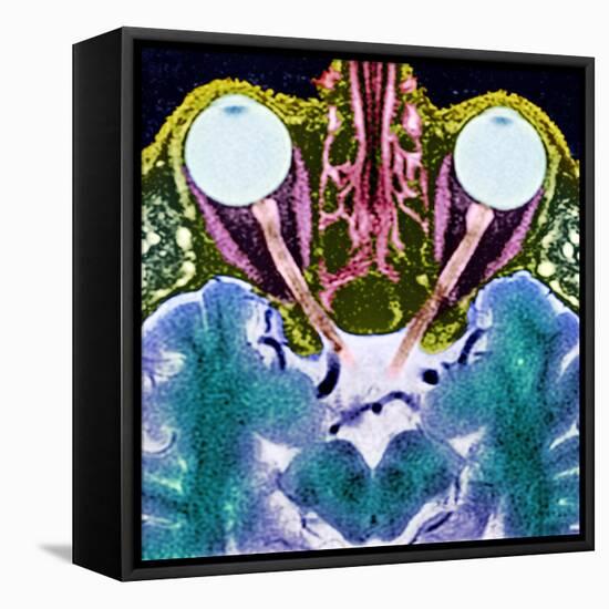 Vision And the Brain, MRI Scan-Science Photo Library-Framed Premier Image Canvas