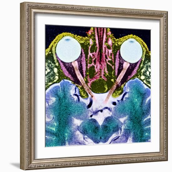 Vision And the Brain, MRI Scan-Science Photo Library-Framed Premium Photographic Print