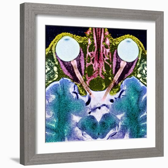 Vision And the Brain, MRI Scan-Science Photo Library-Framed Premium Photographic Print