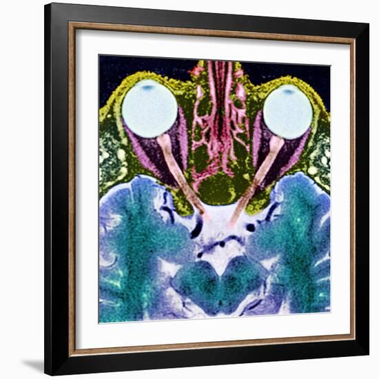 Vision And the Brain, MRI Scan-Science Photo Library-Framed Premium Photographic Print