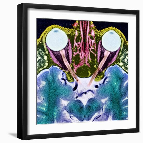 Vision And the Brain, MRI Scan-Science Photo Library-Framed Premium Photographic Print