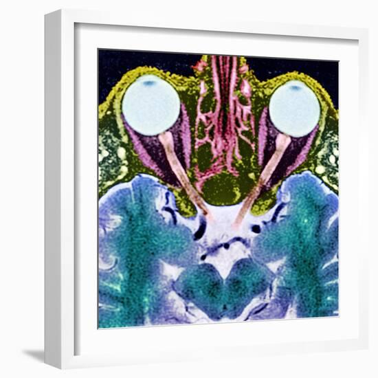 Vision And the Brain, MRI Scan-Science Photo Library-Framed Premium Photographic Print