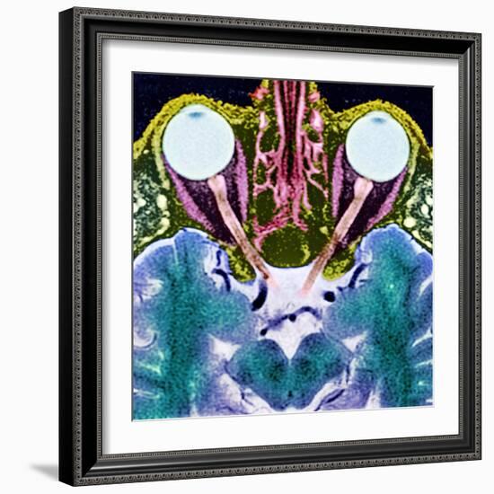 Vision And the Brain, MRI Scan-Science Photo Library-Framed Premium Photographic Print