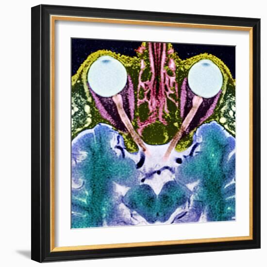 Vision And the Brain, MRI Scan-Science Photo Library-Framed Premium Photographic Print