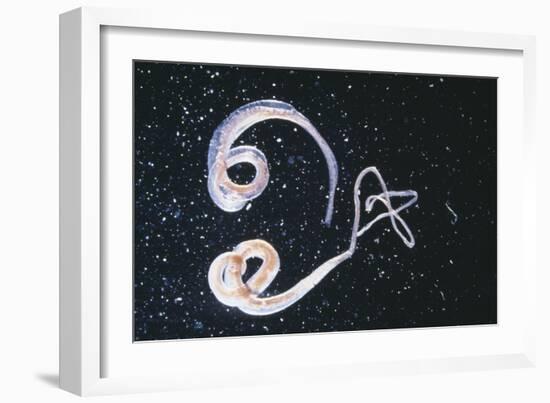 Whipworm Parasites-null-Framed Premium Photographic Print