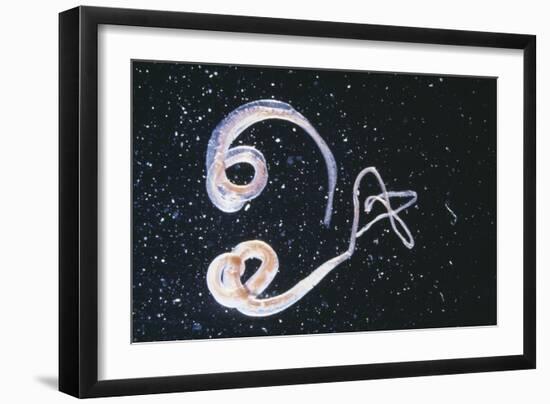 Whipworm Parasites-null-Framed Photographic Print