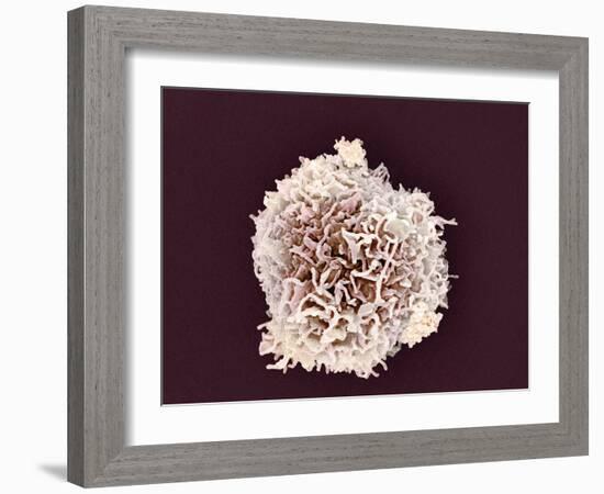 White Blood Cell, SEM-Steve Gschmeissner-Framed Photographic Print