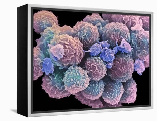 White Blood Cells And Platelets-Steve Gschmeissner-Framed Premier Image Canvas