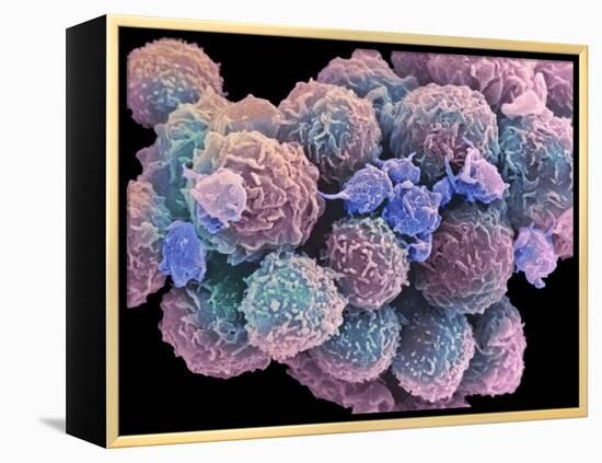 White Blood Cells And Platelets-Steve Gschmeissner-Framed Premier Image Canvas