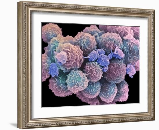 White Blood Cells And Platelets-Steve Gschmeissner-Framed Photographic Print