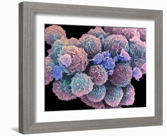 White Blood Cells And Platelets-Steve Gschmeissner-Framed Photographic Print