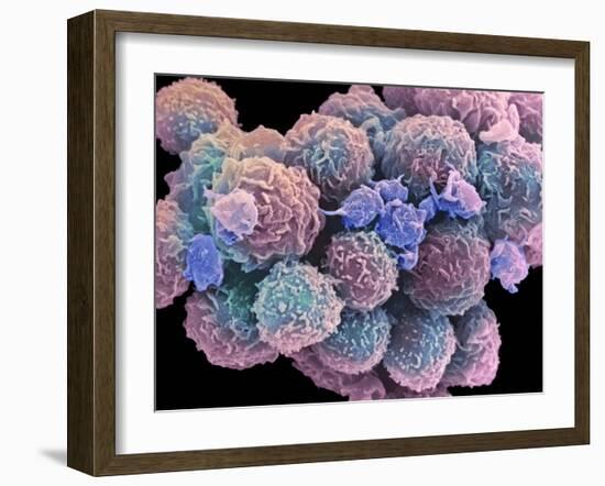 White Blood Cells And Platelets-Steve Gschmeissner-Framed Photographic Print