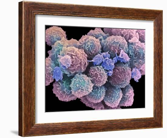 White Blood Cells And Platelets-Steve Gschmeissner-Framed Photographic Print