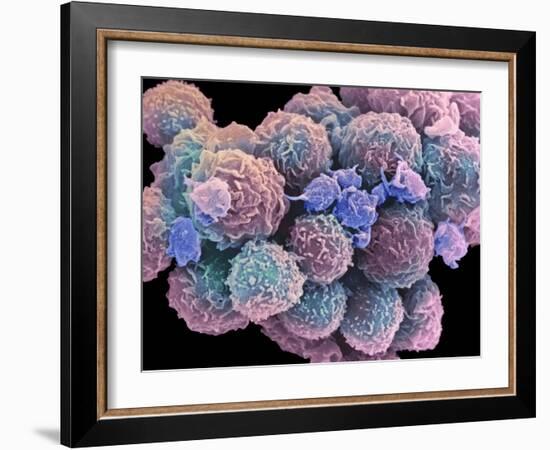 White Blood Cells And Platelets-Steve Gschmeissner-Framed Photographic Print