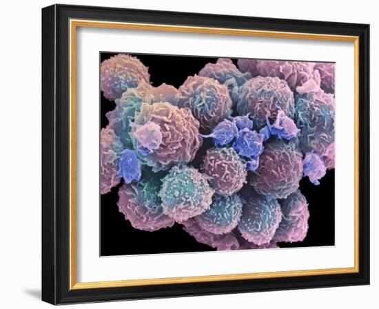 White Blood Cells And Platelets-Steve Gschmeissner-Framed Photographic Print