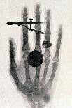 Wilhelm Roentgen's X-Ray Photograph of His Wife's Hand, 1896-Wilhelm Conrad Rontgen-Giclee Print