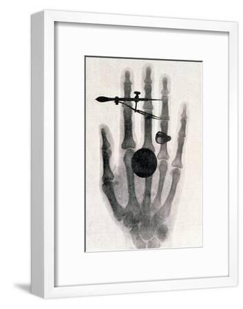 Wilhelm Roentgen S X Ray Photograph Of His Wife S Hand 1896 Giclee Print Wilhelm Conrad Rontgen Art Com
