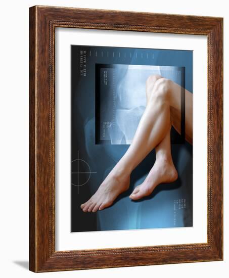 Woman's Legs, with Knee X-ray-Miriam Maslo-Framed Photographic Print